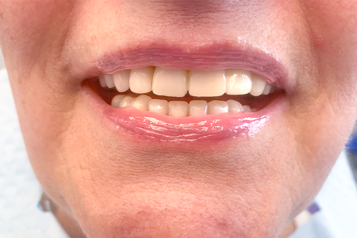 Metamorfoza 12 - po